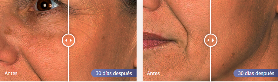 Rechiol Reviews