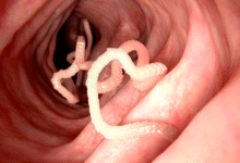 Enzimlex MX